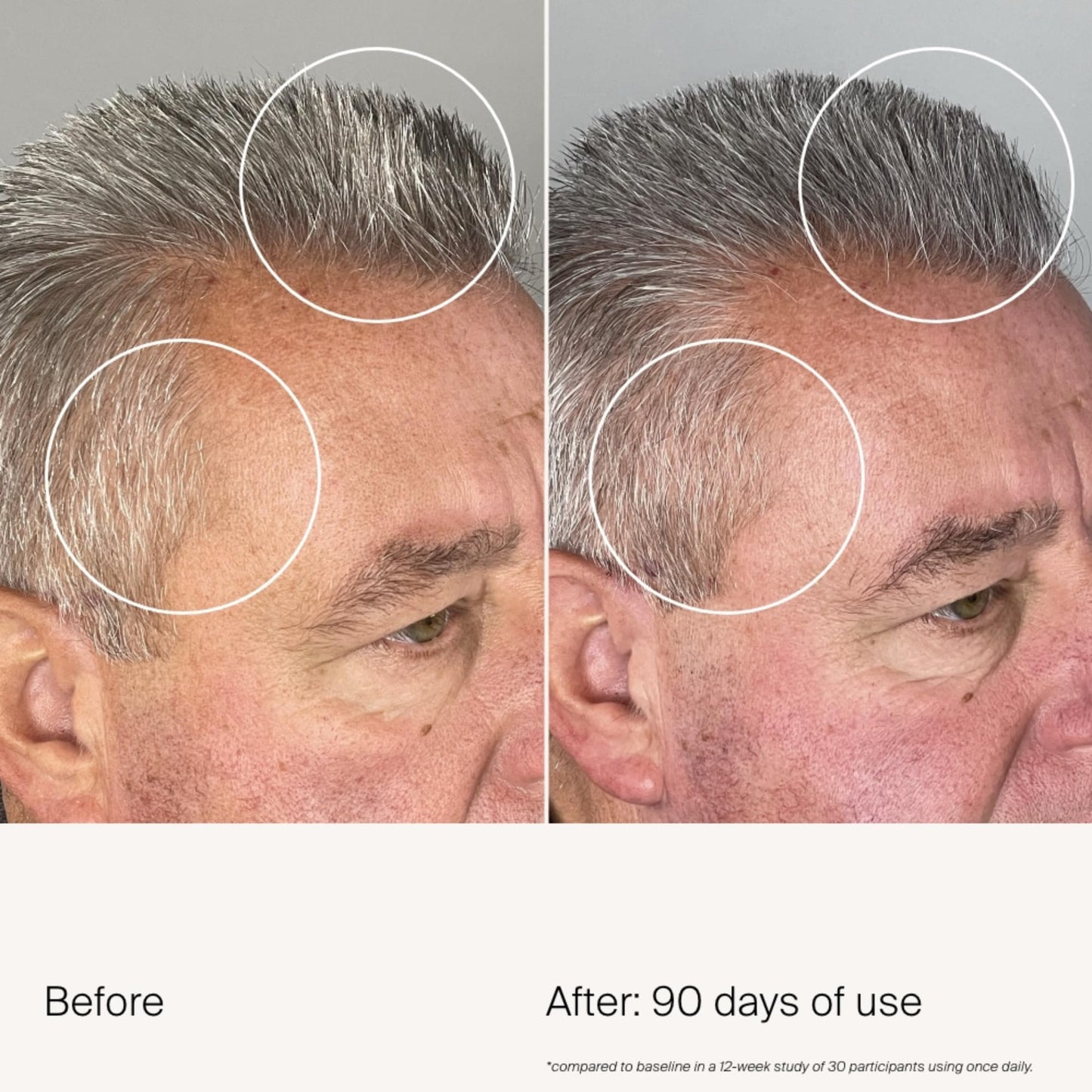 Living Proof Scalp Care Density Serum
